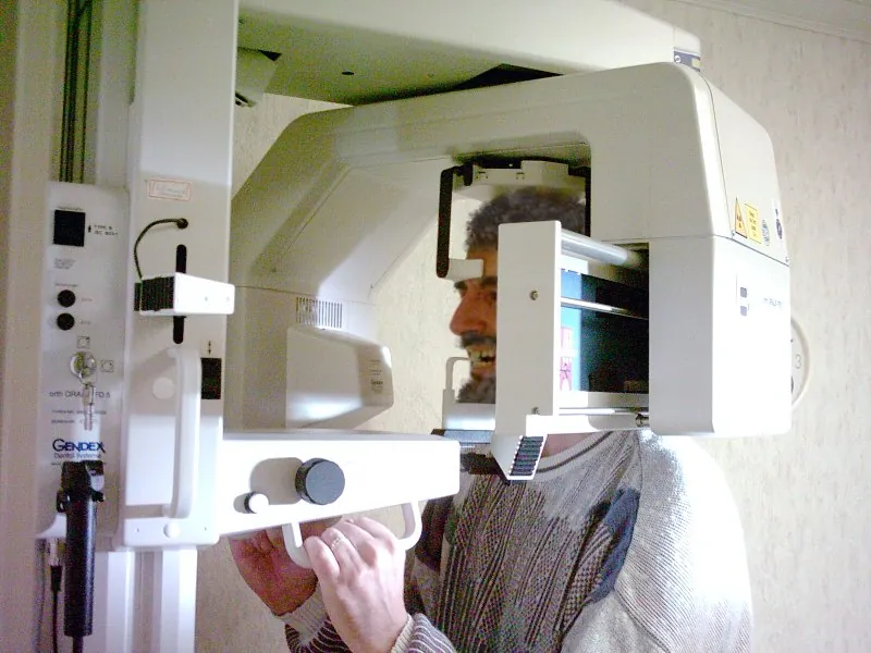 Panoramic dental X-ray used for full mouth assessment