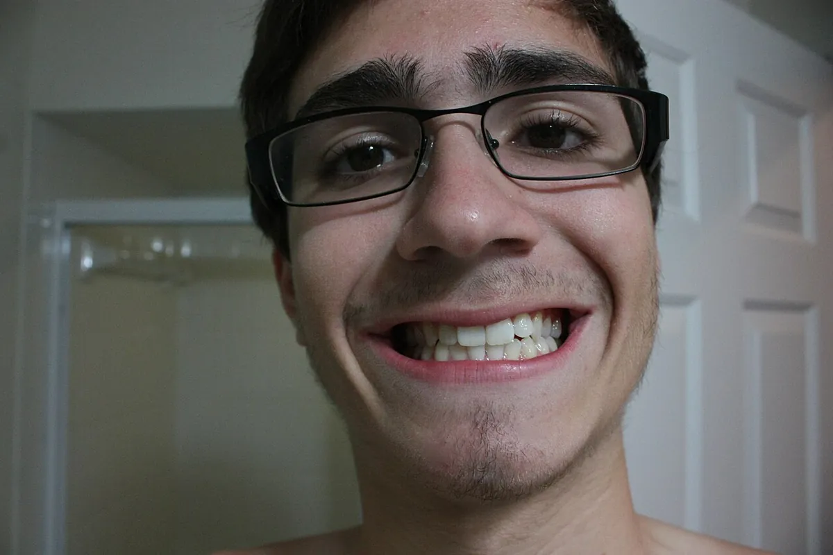 Smile after cosmetic teeth whitening